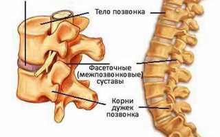 Дискоз: причины, симптомы и методы лечения