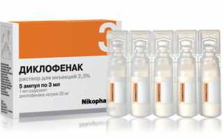Диклофенак при остеохондрозе