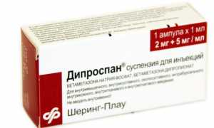 Дипроспан при остеохондрозе