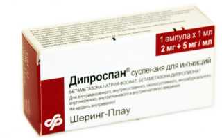 Дипроспан при остеохондрозе