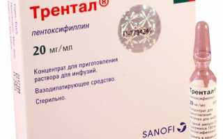 Трентал (таблетки, ампулы): инструкция по применению, цена, отзывы, аналоги