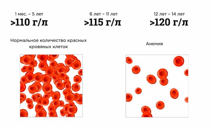 Новокаиновые растворы противопоказаны при анемии в тяжелой форме
