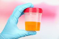 Лечение болезней почек нужно начинать с анализов