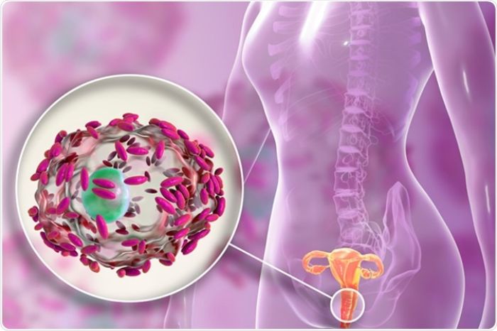 Vaginal Infections