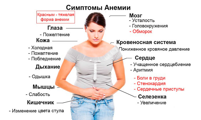 симптомы анемии