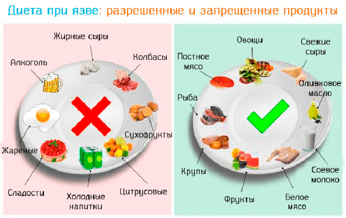 разрешенные и запрещенные продукты