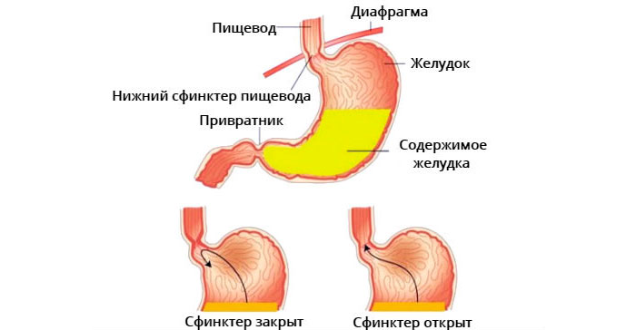 заброс желчи