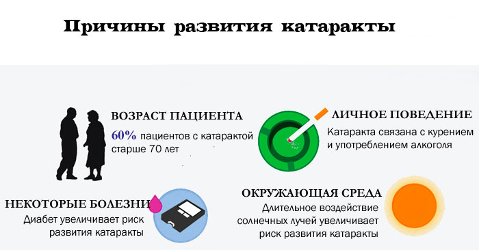 причины катаракты