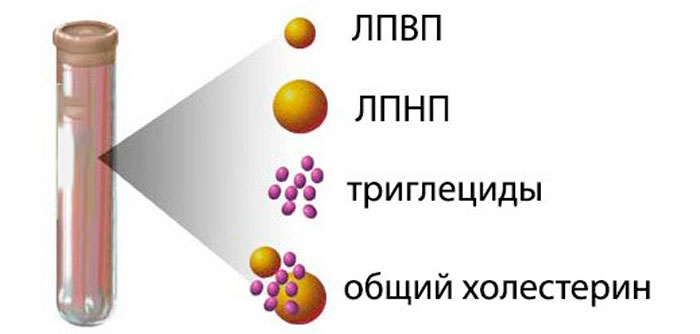 липидограмма