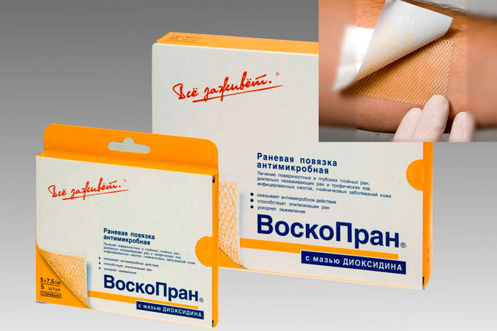 воскопран