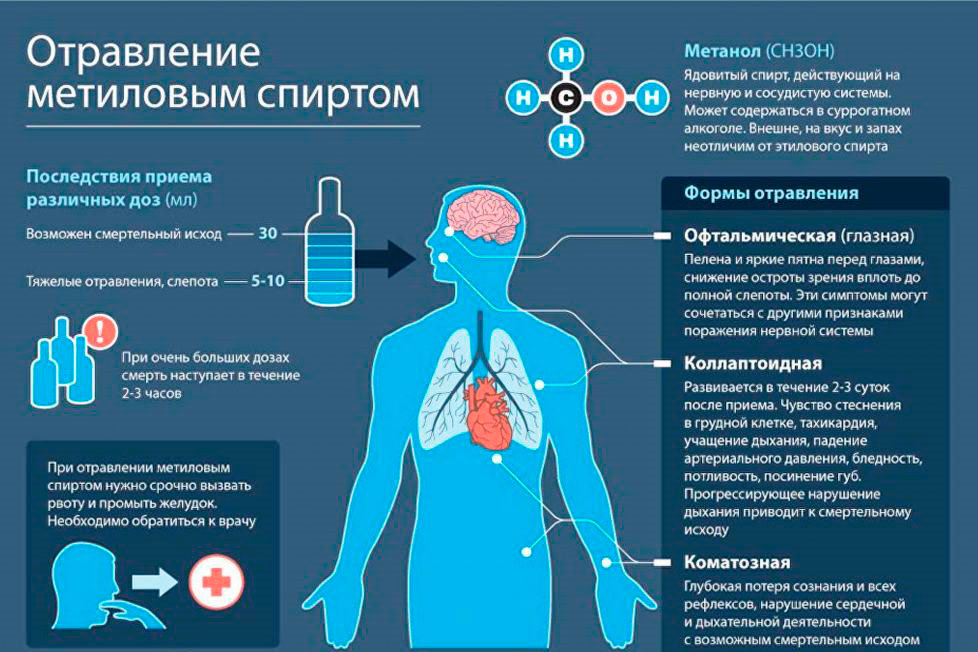 тяжелое отравление метанолом