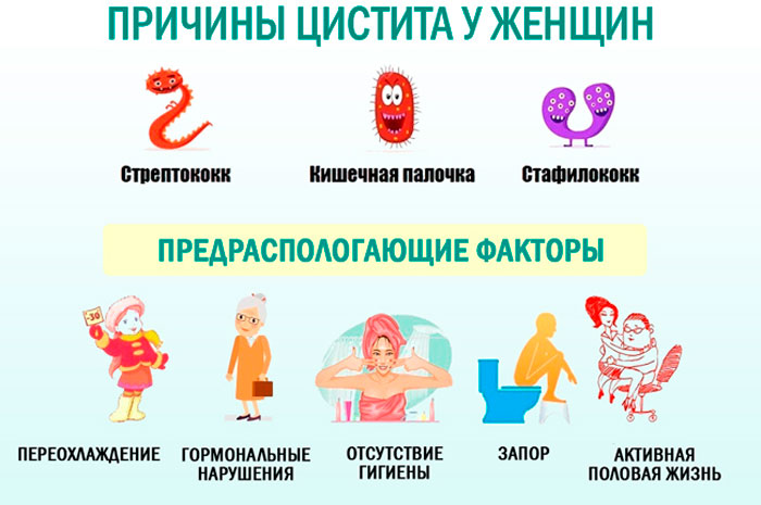 причины цистита