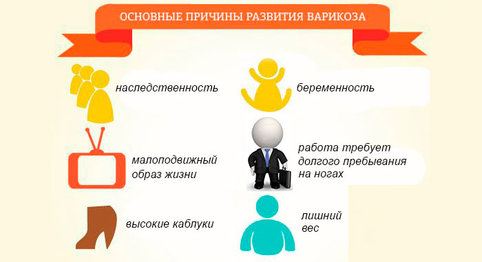 причины варикоза