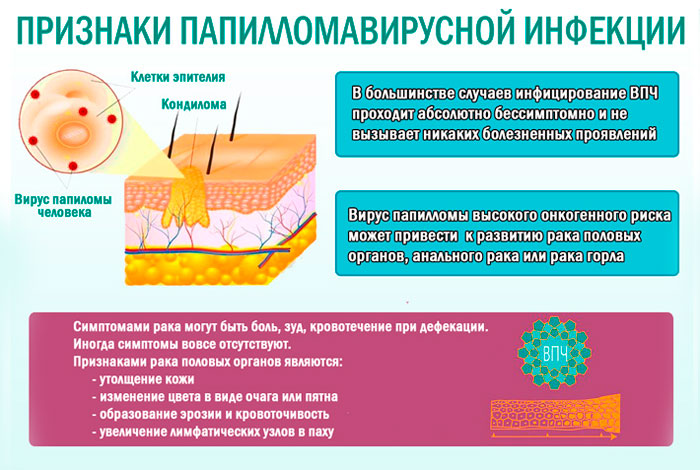 признаки ВПЧ