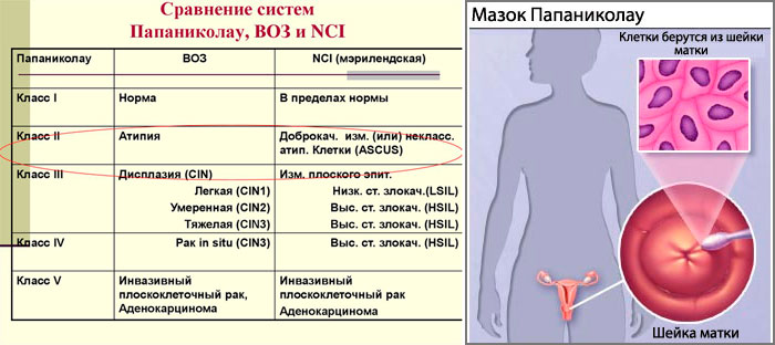 система папаниколау
