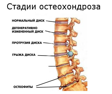 Стадии
